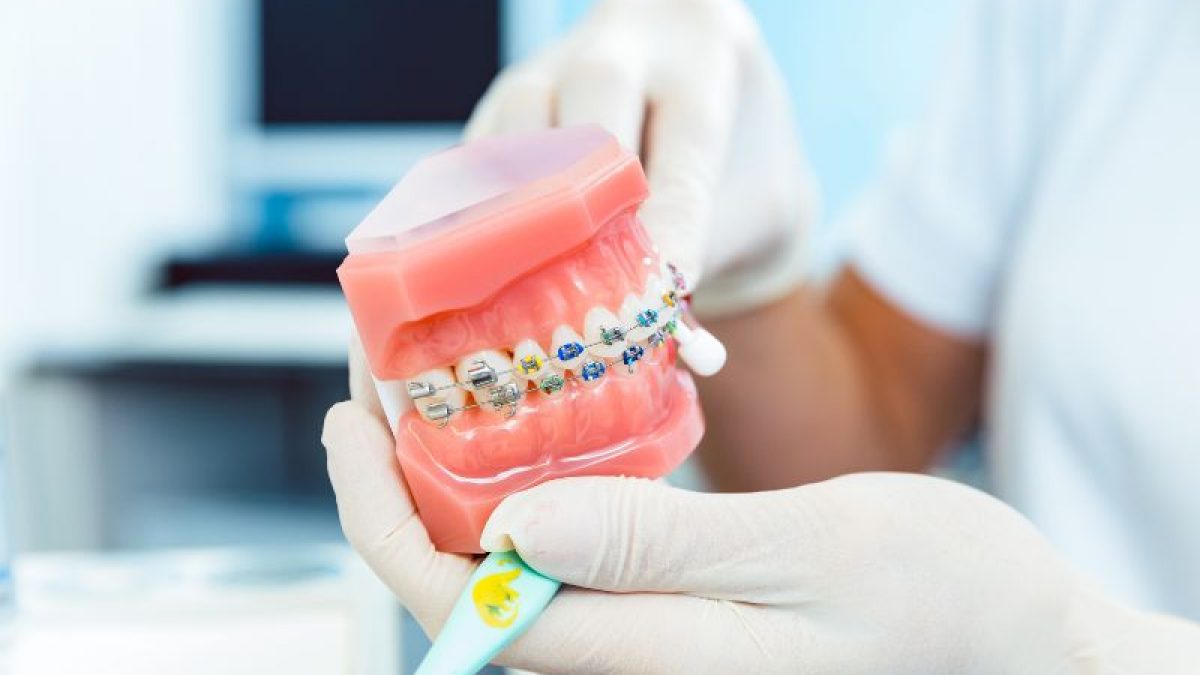 Tips for taking care of your teeth while wearing braces